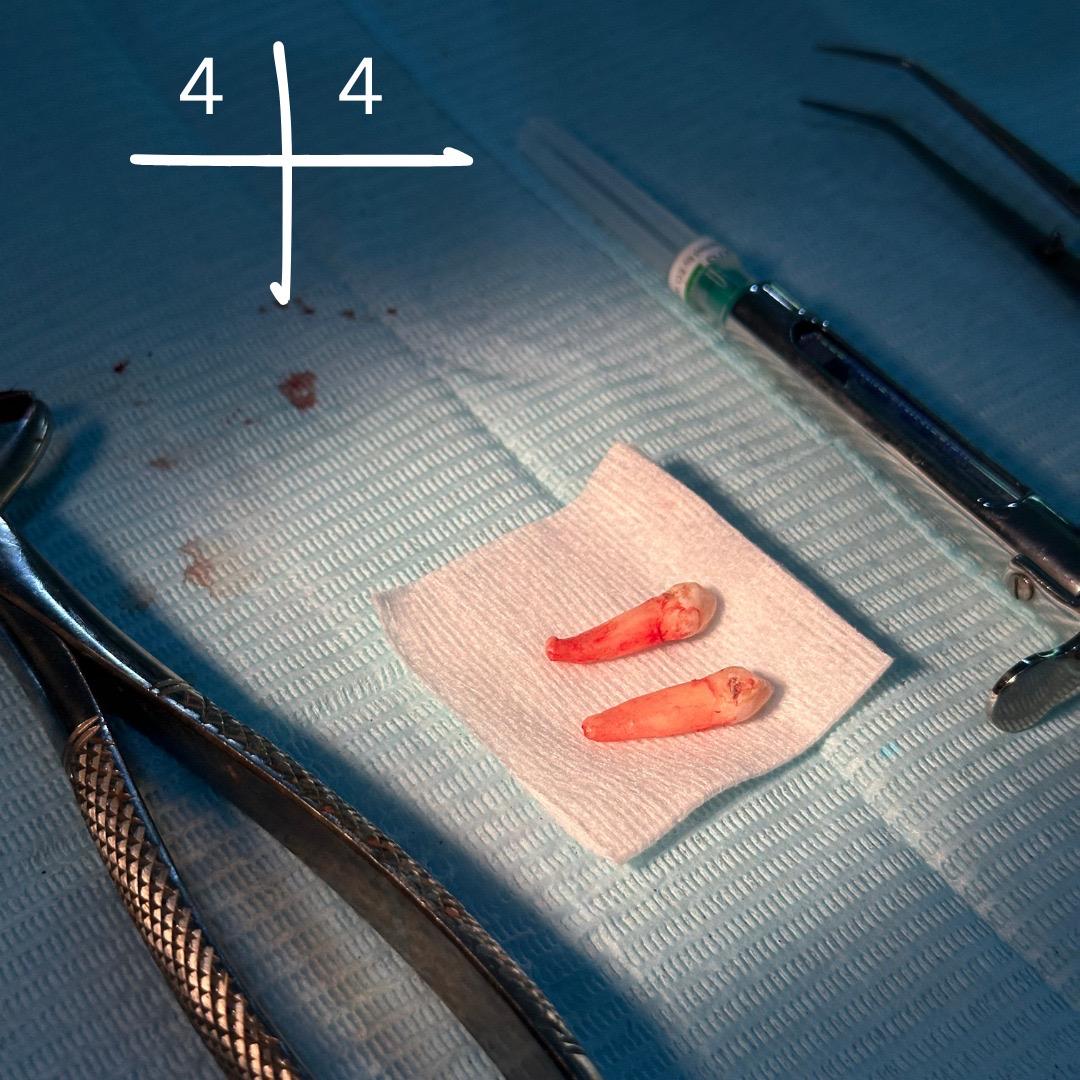 Dental treatment cases at Dental Specialists Lahore